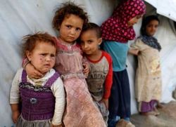 روایت یک روزنامه آلمانی از رنج کودکان گرسنه یمنی