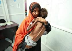 تروریسم بهداشی و دارویی علیه مردم یمن؛ مرگ و میر هزاران نفر بر اثر وبا