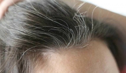 ۱۰ دلیل سفید شدن مو‌ها + ۵ توصیه برای پیشگیری از آن