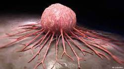 تشخیص زودرس سرطان اثربخشی درمان را افزایش می‌دهد