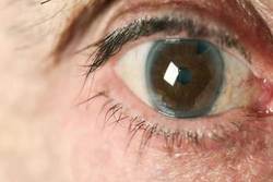 اهمیت قسمت سفید چشم و کاربرد آن