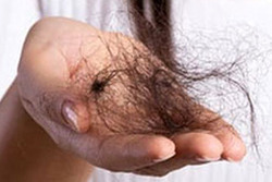 درمان ریزش مو با ویتامین بیوتین