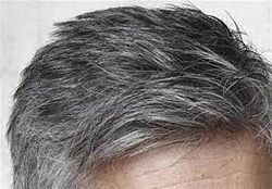 سفید شدن موها و راه‌های جلوگیری از آن
