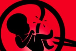 مجازات «ابطال پروانه» برای سقط جنین