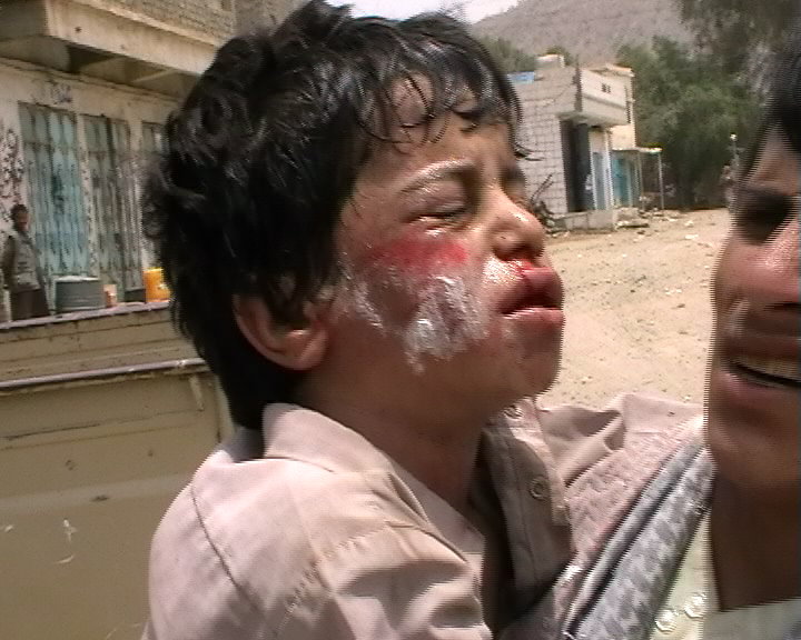 سرزمين صعده يمن