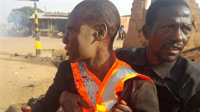 A bloodied mourner is being helped by a resident in the Nigerian city of Funtua, Oct. 12, 2016.