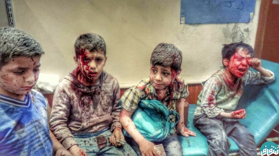 تصویر کودکان یمنی که در حملات عربستان مجروح شده اند.