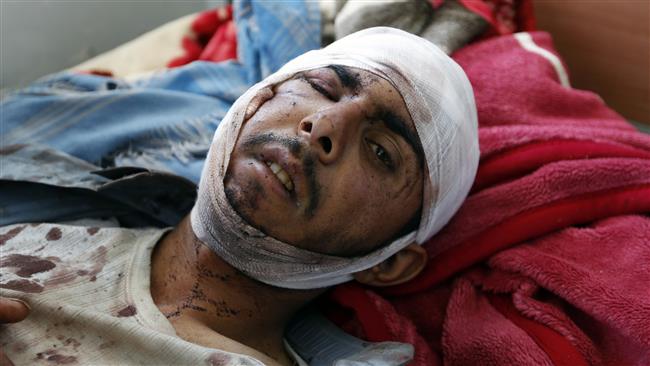 A man who was wounded in a Saudi airstrike on a funeral in the Yemeni capital, Sana’a, lies on a hospital bed on