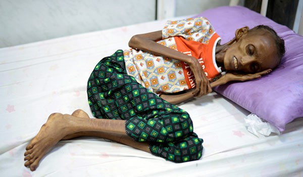 Yemen