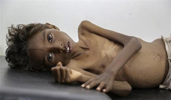 Yemen