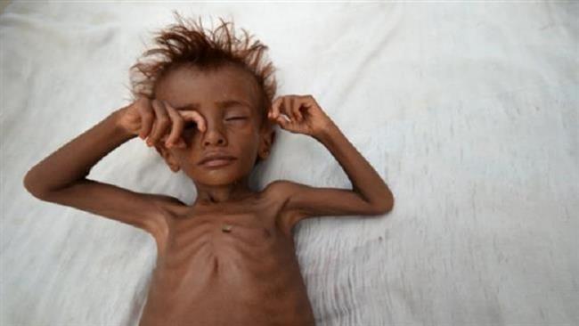 Yemen