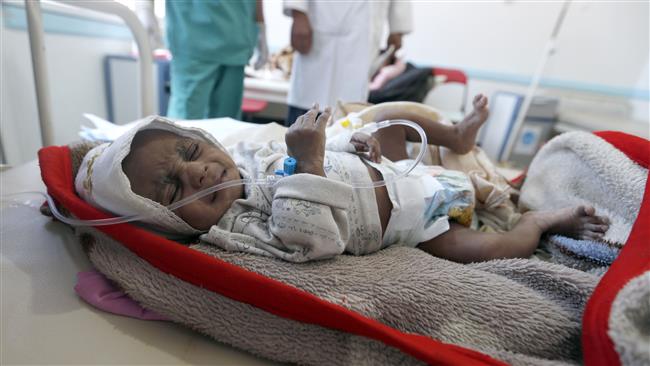 A Yemeni child suspected of being infected with cholera receives treatment at a hospital in Sana’a, the capital city of Yemen, on May 25, 2017. (Photo by AFP)