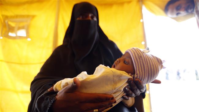 A Yemeni mother holds her child suspected of being infected with cholera at a makeshift hospital in Sana’a on June 9, 2017. (Photo by AFP)