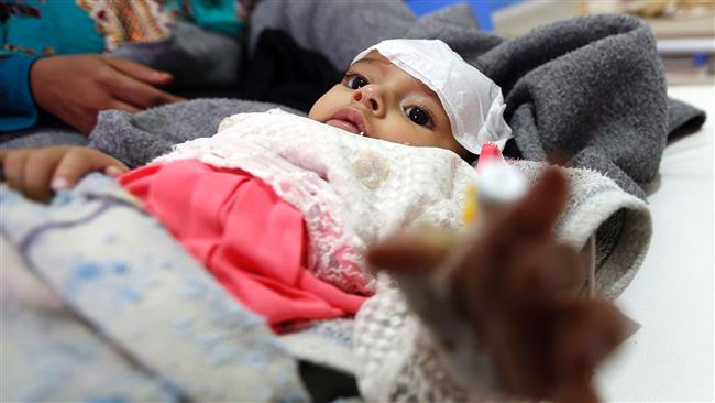 The photo taken on June 13, 2017 shows a Yemeni infant suspected of being infected with cholera receiving treatment at a hospital in the capital Sana’a. (AFP photo)