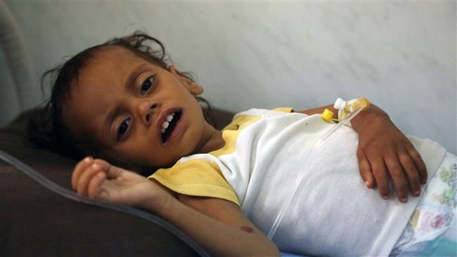A Yemeni child receives treatment at a hospital in the coastal city of Hudaydah on November 11, 2017. (Photo by AFP)