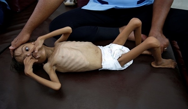 Yemen