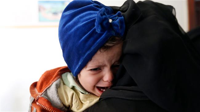 A Yemeni child suffering from malnutrition waits to be checked by a doctor at a medical center on the outskirts of the capital Sana’a, January 25, 2018. (Photo by AFP)
