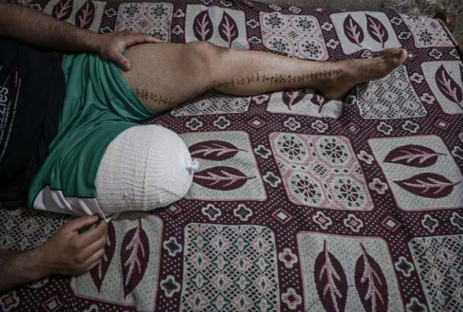 Palestinian cyclist Alaa al-Daly, 21, rests at his home in Rafah in the southern Gaza Strip on April 19. Daly’s dream of competing in the Asian Games was shattered after he lost his leg, struck by a bullet fired by an Israeli regime’s force during a protest along the Gaza border.