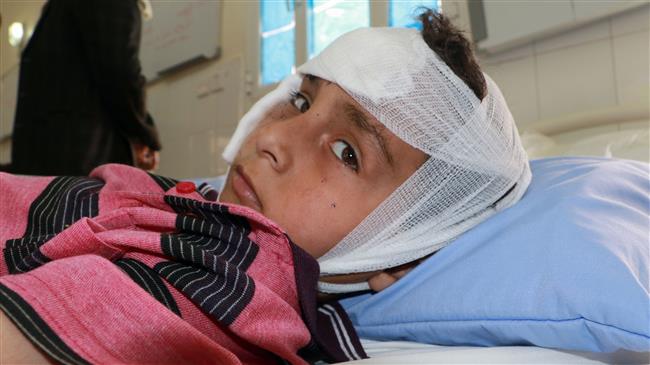 A Yemeni boy wounded in a Saudi-led airstrike on a bus at a market in northern Yemen lies on his hospital in the Yemeni city of Sa’ada on August 10 2018. (Photo by AFP)