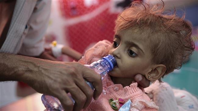 In this September 27, 2018 photo, a father gives water to his malnourished daughter at a feeding center in a hospital in western Yemeni province of Hudaydah. (Photo by AP)