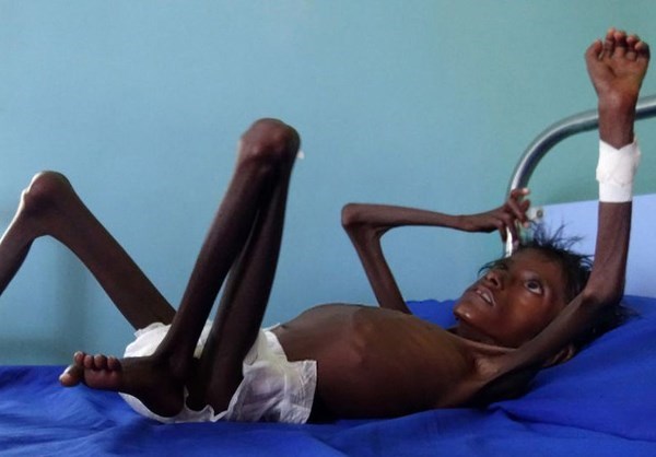 Humanitarian Crisis in Yemen