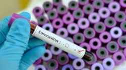 آمار مبتلایان به ویروس کرونا در لرستان به ۲۱۰ نفر رسیده است