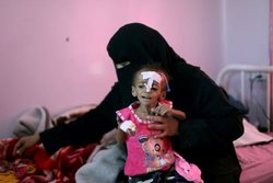 «شمارش معکوس برای وقوع یک فاجعه» در یمن