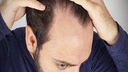 ترکیب هوای خشک داخل خانه و باد‌های سرد بیرون عامل ریزش مو