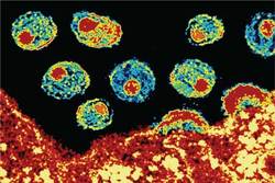 شناسایی سویه متفاوت و عفونی‌تری از ویروس اچ‌آ‌ی‌وی