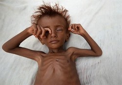 ۱۶میلیون یمنی در آستانه قحطی و گرسنگی هستند