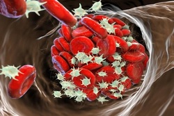 خطر لخته های خون در مبتلایان به کووید 19