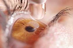 عومل موثر بر پیشگیری از پیر چشمی