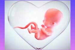 عسر و حرج در سقط جنین