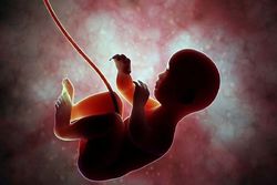 افزایش خطر سکته مغزی با ناباروری و سقط جنین