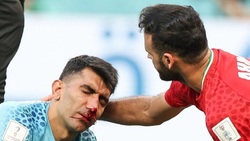 علیرضا بیرانوند جام جهانی را از دست داد