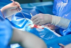 برای چهارمین بار در جهان؛ جراحی موفقیت آمیز پیوند سر در ایران
