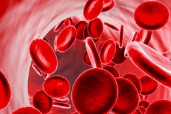 چگونه کم خونی را درمان کنیم؟