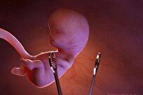 خطر مرگ و نازایی در سقط جنین های غیر قانونی