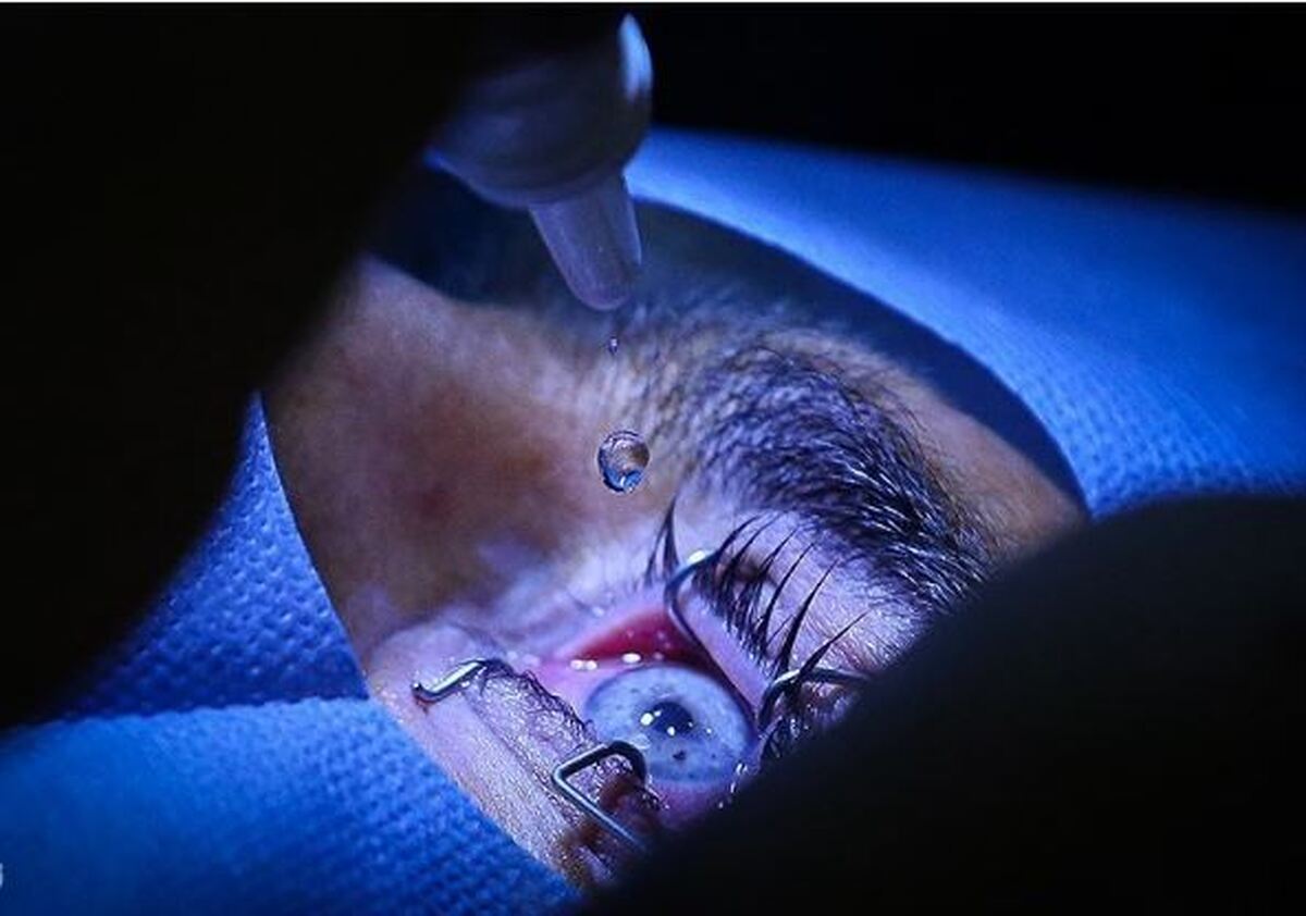 ردپای یک پزشک و مقام سابق مشهور در انجام جراحی ممنوعه/ اعزام بیماران از ایران به عمان برای تغییر رنگ چشم