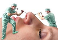 "بلک فرآیدی" تله تبلیغاتی کلینیک‌های زیبایی برای جذب مشتری/ خطر خدمات زیبایی پرتخفیف