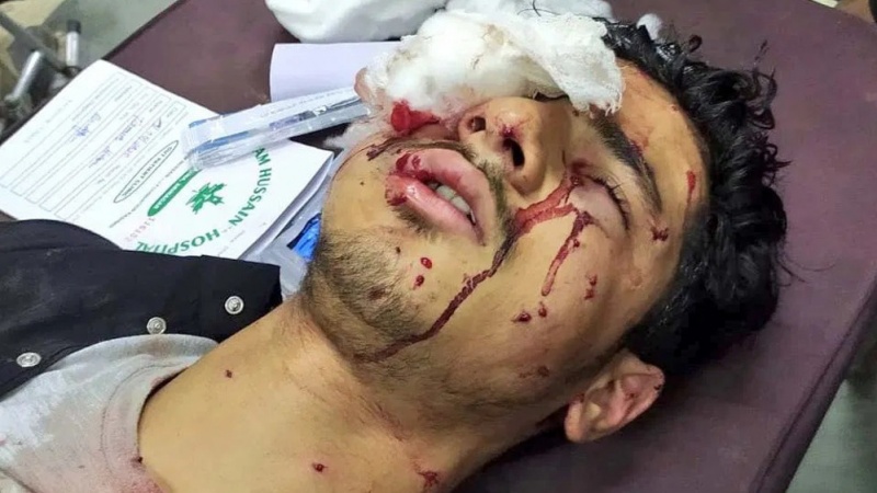 عزاداروں کو نشانہ بنانے کے واقعات کی تحقیقات کی جائے عزاداروں کو نشانہ بنانے کے واقعات کی تحقیقات کی جائے