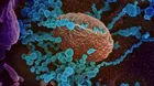 Drug for coronavirus treatment via stem cells made in Iran