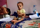 1,000 Yemeni Children Die Daily Due to Saudi-Led Attacks, Siege