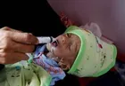 50,000 children die every year in Yemen