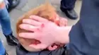 Boy suffers head injury from police truncheon after Barnsley football match